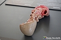 VBS_2730 - Pancreas - Mostra Body Worlds
